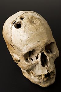 bronze_age_skull_from_jericho_palestine