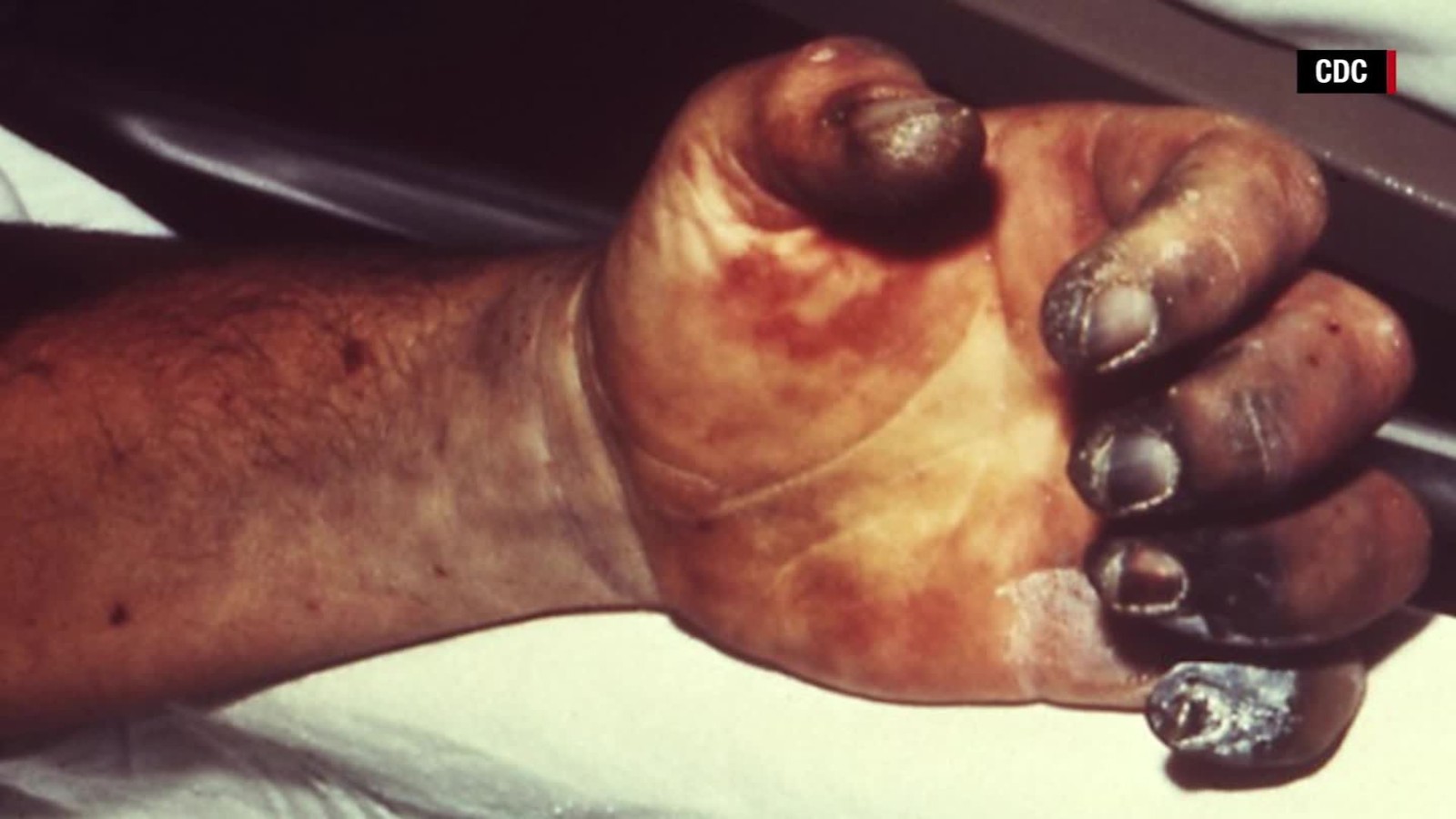 150827150729-plague-explainer-cohen-orig-mg-00001604-full-169