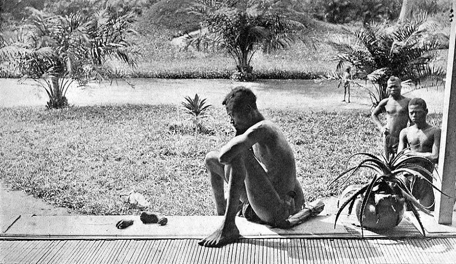 leopold-ii-daughters-limbs